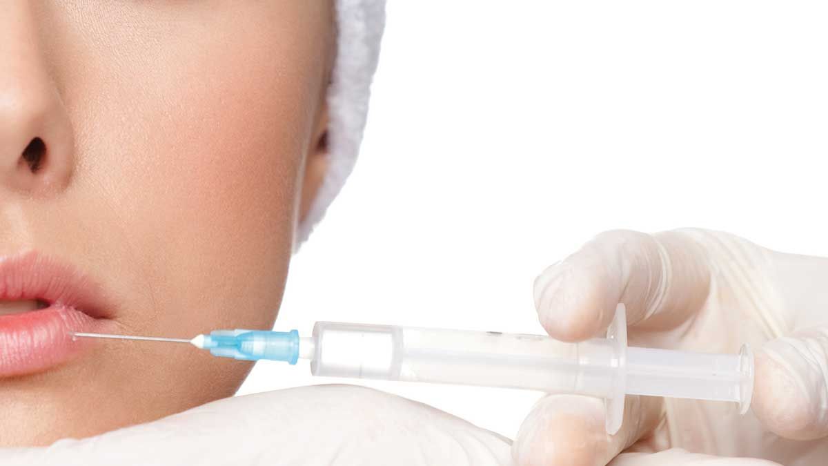 Injection d’acide hyaluronique